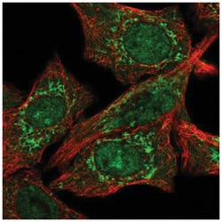 CLPX Antibody, Novus Biologicals:Antibodies:Primary Antibodies