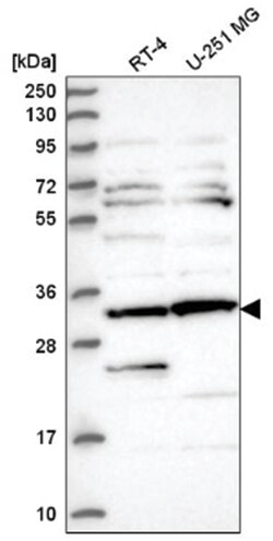 CLUAP1 Antibody, Novus Biologicals 100 &mu;L | Buy Online | Novus Biologicals | Fisher Scientific
