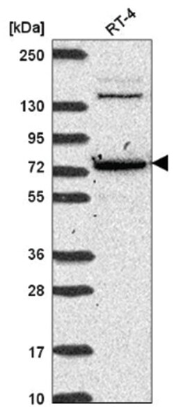CMIP Antibody, Novus Biologicals 100&mu;L; Unlabeled:Antibodies, Polyclonal