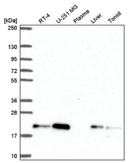 CNBP Antibody, Novus Biologicals 100&mu;L; Unlabeled:Antibodies, Polyclonal