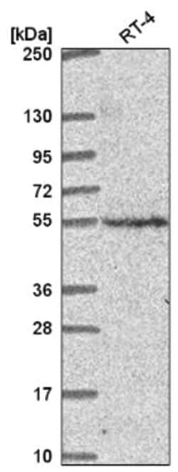 CNNM2 Antibody, Novus Biologicals 100&mu;L; Unlabeled:Antibodies, Polyclonal