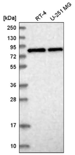 CNOT10 Antibody, Novus Biologicals 25 &mu;L; Unlabeled:Antibodies, Polyclonal
