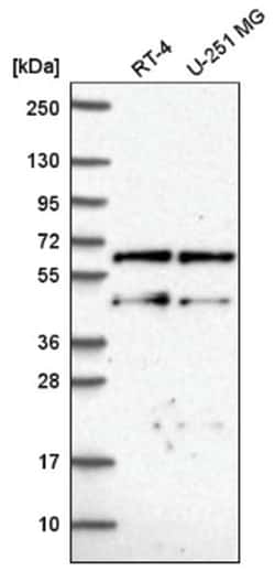 CNOT2 Antibody, Novus Biologicals 100&mu;L; Unlabeled:Antibodies, Polyclonal