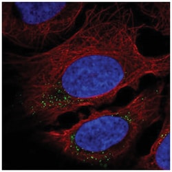 CNST Antibody, Novus Biologicals:Antibodies:Primary Antibodies