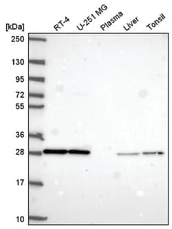 Coagulation Factor III/Tissue Factor Antibody, Novus Biologicals:Antibodies:Primary