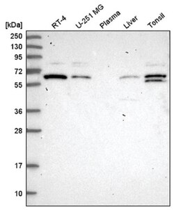 Coatomer Subunit Delta Antibody, Novus Biologicals 25 &mu;L:Antibodies,