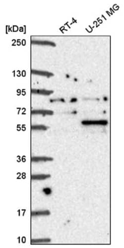 Coilin Antibody, Novus Biologicals 100 &mu;L | Buy Online | Novus Biologicals | Fisher Scientific
