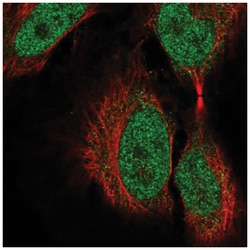 COL9A3 Antibody, Novus Biologicals 100 &mu;L | Buy Online | Novus Biologicals | Fisher Scientific