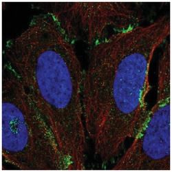 CL-P1/COLEC12 Antibody, Novus Biologicals 100&mu;L; Unlabeled:Antibodies,