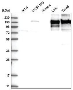 Collagen VI alpha 2 Antibody, Novus Biologicals 100&mu;L; Unlabeled:Antibodies,