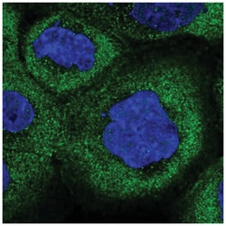 COLQ Antibody, Novus Biologicals:Antibodies:Primary Antibodies