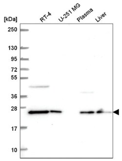 COMMD7 Antibody, Novus Biologicals:Antibodies:Primary Antibodies