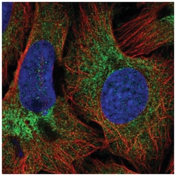 COPB2 Antibody, Novus Biologicals 100&mu;L; Unlabeled:Antibodies, Polyclonal