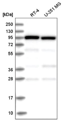 COPG Antibody, Novus Biologicals 25 &mu;L:Anticorps, Polyclonal