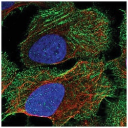 Corin Antibody, Novus Biologicals 25 &mu;L, Unlabeled:Antibodies, Polyclonal