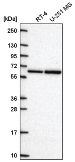 CPEB2 Rabbit anti-Human, Polyclonal, Novus Biologicals 100&mu;L; Unlabeled:Antibodies,