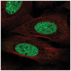 CPEB3 Antibody, Novus Biologicals 100&mu;L; Unlabeled:Antibodies, Polyclonal