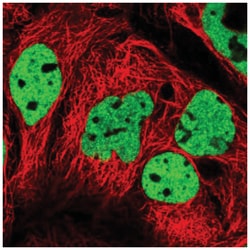 CPI17 alpha Antibody, Novus Biologicals:Antibodies:Primary Antibodies