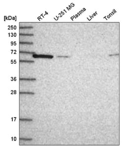 CPNE1 Antibody, Novus Biologicals 100&mu;L; Unlabeled:Antibodies, Polyclonal