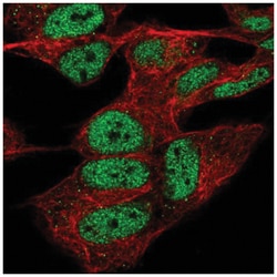 CPSF4 Antibody, Novus Biologicals 100&mu;L; Unlabeled:Antibodies, Polyclonal