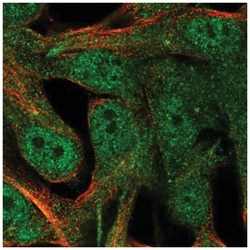CRALBP Antibody, Novus Biologicals:Antibodies:Primary Antibodies