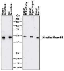 Human/Mouse/Rat Creatine Kinase BB Antibody, R D Systems:Antibodies:Primary