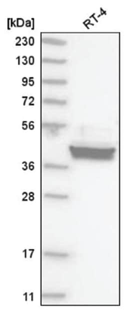 CREB3 Antibody, Novus Biologicals 25 &mu;L, Unlabeled:Antibodies, Polyclonal