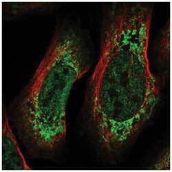 CREB3L2 Antibody, Novus Biologicals 100&mu;L; Unlabeled:Antibodies, Polyclonal