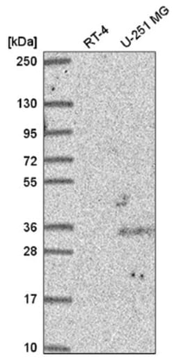 CREB5 Antibody, Novus Biologicals 100&mu;L; Unlabeled:Antibodies, Polyclonal