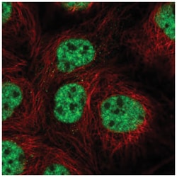 csl/RBPJK Antibody, Novus Biologicals:Antibodies:Primary Antibodies