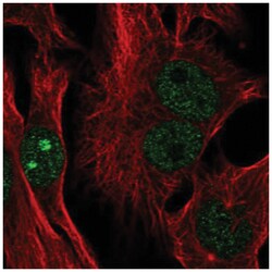 CTC-534A2.2 Antibody, Novus Biologicals 25 &mu;L, Unlabeled:Antibodies,