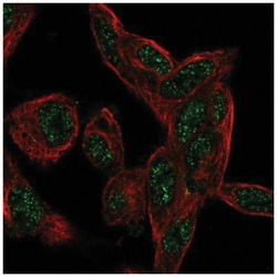CTDSP1 Antibody, Novus Biologicals 25 &mu;L, Unlabeled:Antibodies, Polyclonal