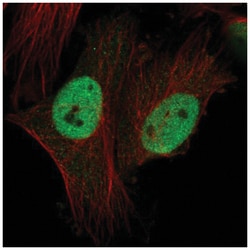 CTDSPL2 Antibody, Novus Biologicals 25 &mu;L, Unlabeled:Antibodies, Polyclonal