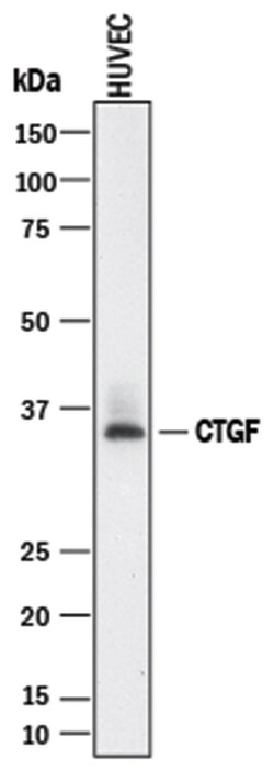 Human CTGF/CCN2 Antibody, R D Systems 100&mu;g; Unlabeled:Antibodies, Monoclonal