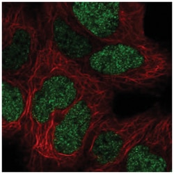 CTR9 Antibody, Novus Biologicals:Antibodies:Primary Antibodies