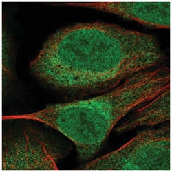 CUEDC2 Antibody, Novus Biologicals 100&mu;L; Unlabeled:Antibodies, Polyclonal