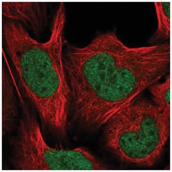 CUL4B Antibody, Novus Biologicals:Antibodies:Primary Antibodies