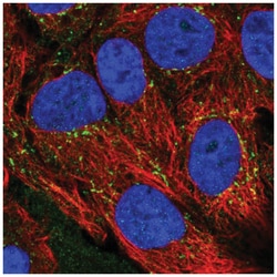 CXCL16 Antibody, Novus Biologicals 25 &mu;L, Unlabeled:Antibodies, Polyclonal