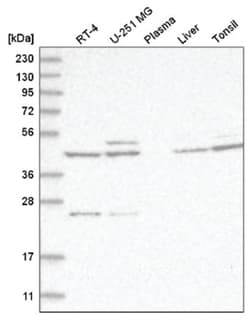 CXCR7/RDC-1 Antibody, Novus Biologicals 25 &mu;L, Unlabeled:Antibodies,