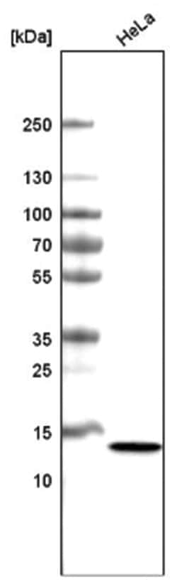 CT83 Antibody (CL4762), Novus Biologicals 25 &mu;L; Unlabeled:Antibodies,