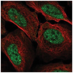 Cyclin A1 Antibody, Novus Biologicals 25 &mu;L:Antibodies, Polyclonal