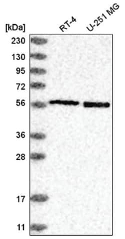 Cyclin B1 Antibody, Novus Biologicals 25 &mu;L:Antibodies, Polyclonal