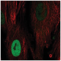Cyclin D1 Antibody, Novus Biologicals 25 &mu;L, Unlabeled:Antibodies, Polyclonal