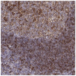 Cyclin F Antibody, Novus Biologicals 25 &mu;L, Unlabeled:Antibodies, Polyclonal