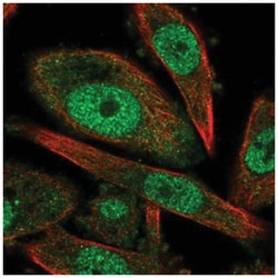 Cyclin H Antibody, Novus Biologicals:Antibodies:Primary Antibodies