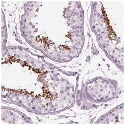 Cylicin 1 Antibody, Novus Biologicals:Antibodies:Primary Antibodies