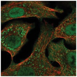 CYP24A1 Antibody, Novus Biologicals 100&mu;L; Unlabeled:Antibodies, Polyclonal
