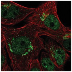 CYP2U1 Antibody, Novus Biologicals:Antibodies:Primary Antibodies