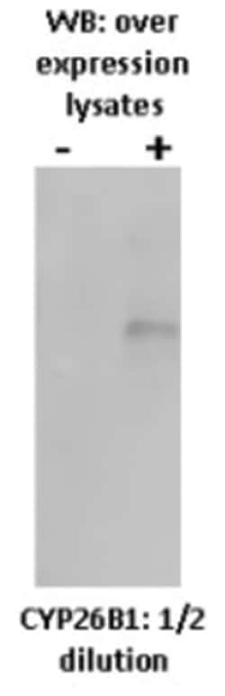 Cytochrome P450 26B1 Mouse anti-Human, Mouse, Rat, Clone: T5P3G2/A3, Novus