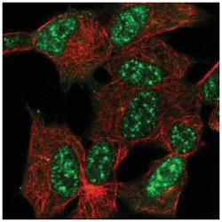 Cytoglobin Antibody, Novus Biologicals:Antibodies:Primary Antibodies